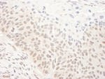 DHX33 Antibody in Immunohistochemistry (IHC)