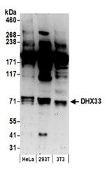 DHX33 Antibody in Western Blot (WB)