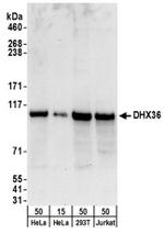 DHX36 Antibody in Western Blot (WB)