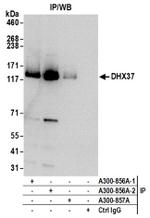 DHX37 Antibody in Western Blot (WB)