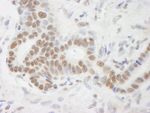 DHX9 Antibody in Immunohistochemistry (IHC)