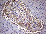 DICER1 Antibody in Immunohistochemistry (Paraffin) (IHC (P))