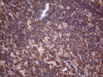 DICER1 Antibody in Immunohistochemistry (Paraffin) (IHC (P))