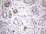 DICER1 Antibody in Immunohistochemistry (Paraffin) (IHC (P))