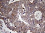 DICER1 Antibody in Immunohistochemistry (Paraffin) (IHC (P))