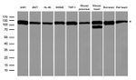 DISC1 Antibody in Western Blot (WB)