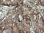 DIXDC1 Antibody in Immunohistochemistry (Paraffin) (IHC (P))