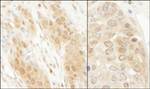 DJ-1 Antibody in Immunohistochemistry (IHC)