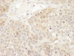 DJ-1 Antibody in Immunohistochemistry (IHC)