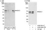 DKC1 Antibody in Western Blot (WB)