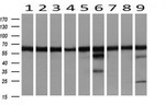 DLD Antibody in Western Blot (WB)