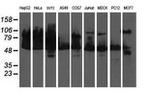 DLD Antibody in Western Blot (WB)