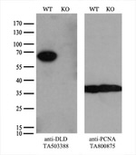 DLD Antibody in Western Blot (WB)