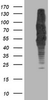 DLD Antibody in Western Blot (WB)