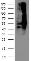 DLD Antibody in Western Blot (WB)