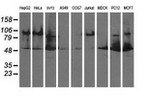 DLD Antibody in Western Blot (WB)