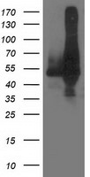 DLD Antibody in Western Blot (WB)