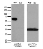 DLD Antibody in Western Blot (WB)