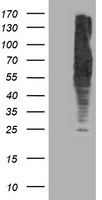 DLD Antibody in Western Blot (WB)