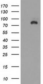 DLG3 Antibody in Western Blot (WB)