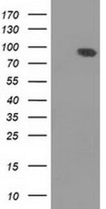 DLG3 Antibody in Western Blot (WB)