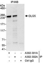 DLG5 Antibody in Immunoprecipitation (IP)