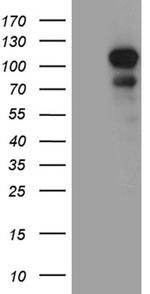 DLGAP3 Antibody in Western Blot (WB)