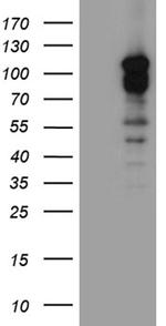 DLGAP3 Antibody in Western Blot (WB)