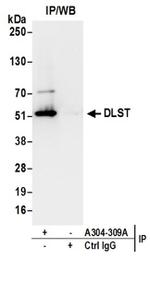 DLST Antibody in Western Blot (WB)