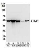 DLST Antibody in Western Blot (WB)