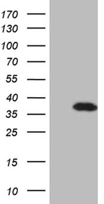 DLX1 Antibody in Western Blot (WB)