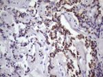 DMRT1 Antibody in Immunohistochemistry (Paraffin) (IHC (P))