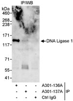 DNA Ligase 1 Antibody in Immunoprecipitation (IP)