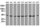 DNAJA2 Antibody in Western Blot (WB)