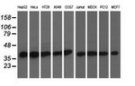 DNAJA2 Antibody in Western Blot (WB)