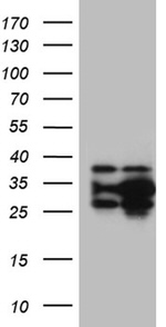 DNAJB6 Antibody in Western Blot (WB)