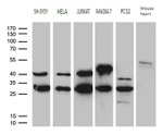 DNAJB6 Antibody in Western Blot (WB)