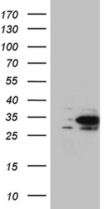 DNAJB6 Antibody in Western Blot (WB)