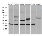 DNAJB6 Antibody in Western Blot (WB)