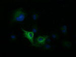 DNM1L Antibody in Immunocytochemistry (ICC/IF)