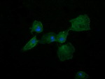 DNM1L Antibody in Immunocytochemistry (ICC/IF)