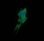 DNM1L Antibody in Immunocytochemistry (ICC/IF)