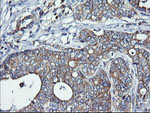 DNM1L Antibody in Immunohistochemistry (Paraffin) (IHC (P))