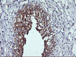 DNM1L Antibody in Immunohistochemistry (Paraffin) (IHC (P))