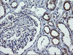 DNM1L Antibody in Immunohistochemistry (Paraffin) (IHC (P))