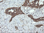 DNM1L Antibody in Immunohistochemistry (Paraffin) (IHC (P))