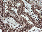 DNM1L Antibody in Immunohistochemistry (Paraffin) (IHC (P))