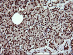 DNM1L Antibody in Immunohistochemistry (Paraffin) (IHC (P))