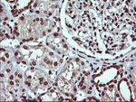 DNM1L Antibody in Immunohistochemistry (Paraffin) (IHC (P))