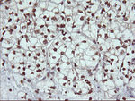 DNM1L Antibody in Immunohistochemistry (Paraffin) (IHC (P))